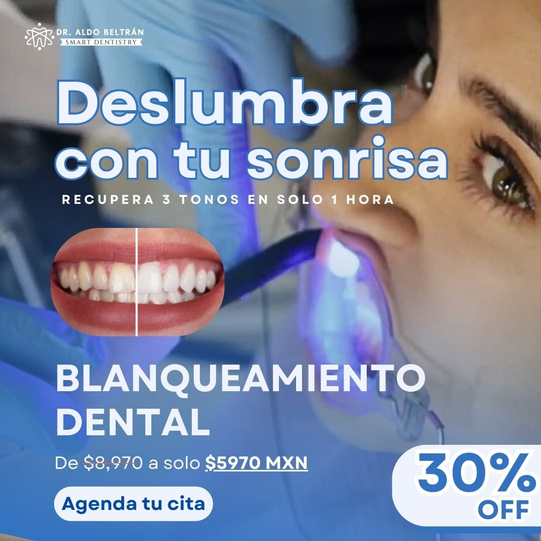 Promociones de blanqueamiento dental del mes de noviembre 2024