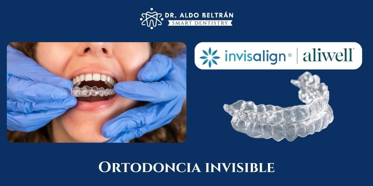 Alineadores invisibles transparentes para el tratamiento de ortodoncia estética